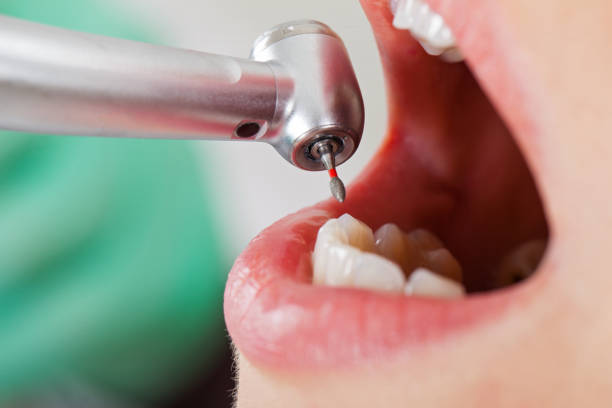 Best Emergency Cosmetic Dentistry in Mauldin, SC